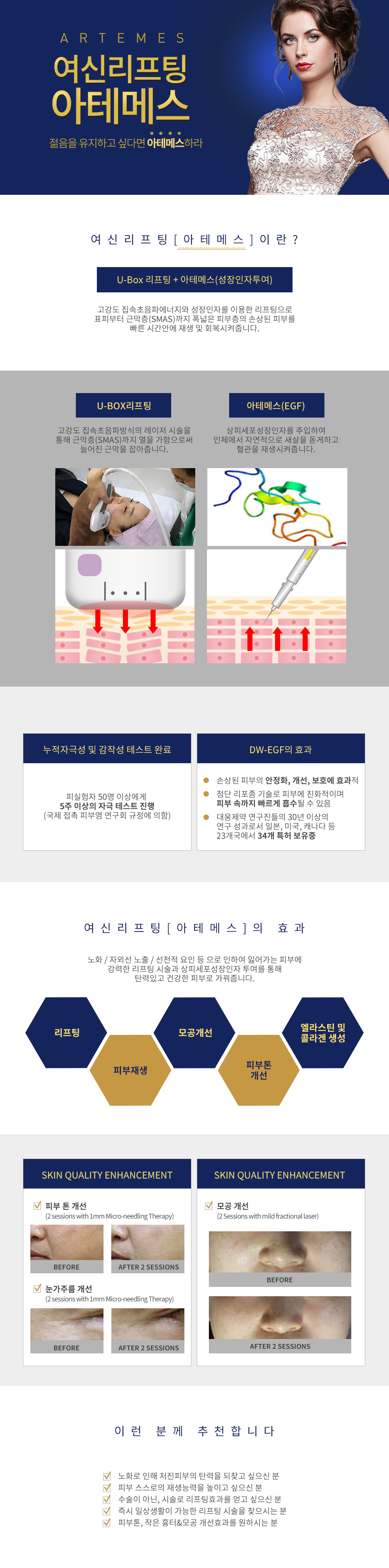 아테메스